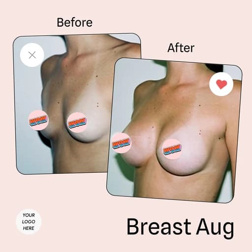 Before and after breast augmentation with private-area covers applied by ClinicOS