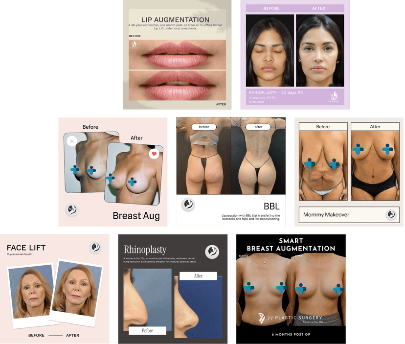 Top Aesthetics: AI Simulations in Practice