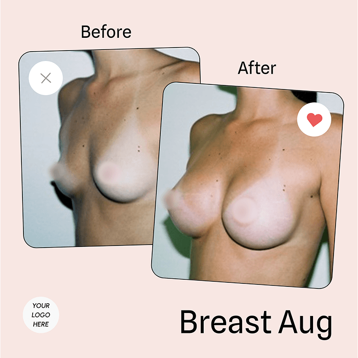 Tummy Tuck vs Liposuction: Educating Patients