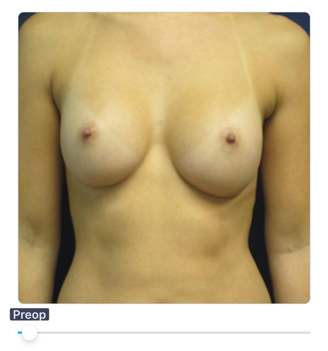 ClinicOS AI Simulation Demo