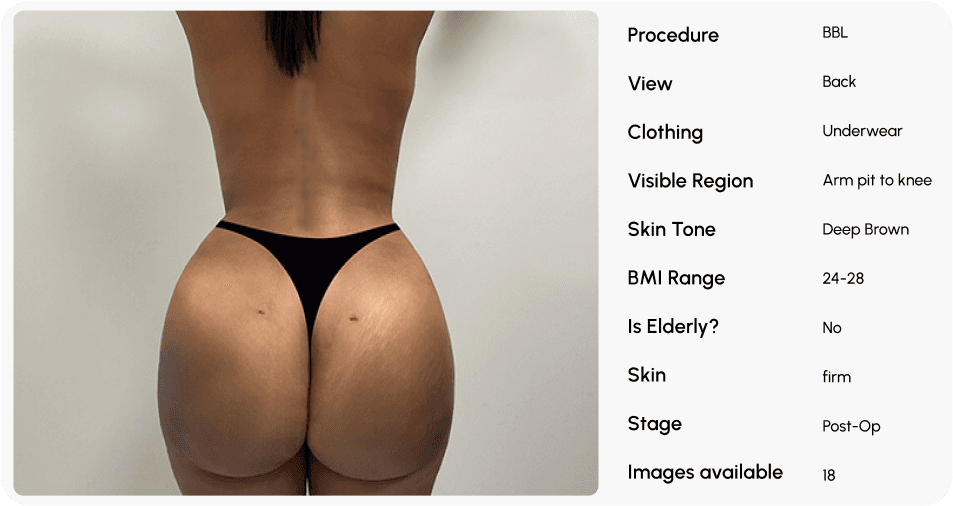 Before/After photo automation