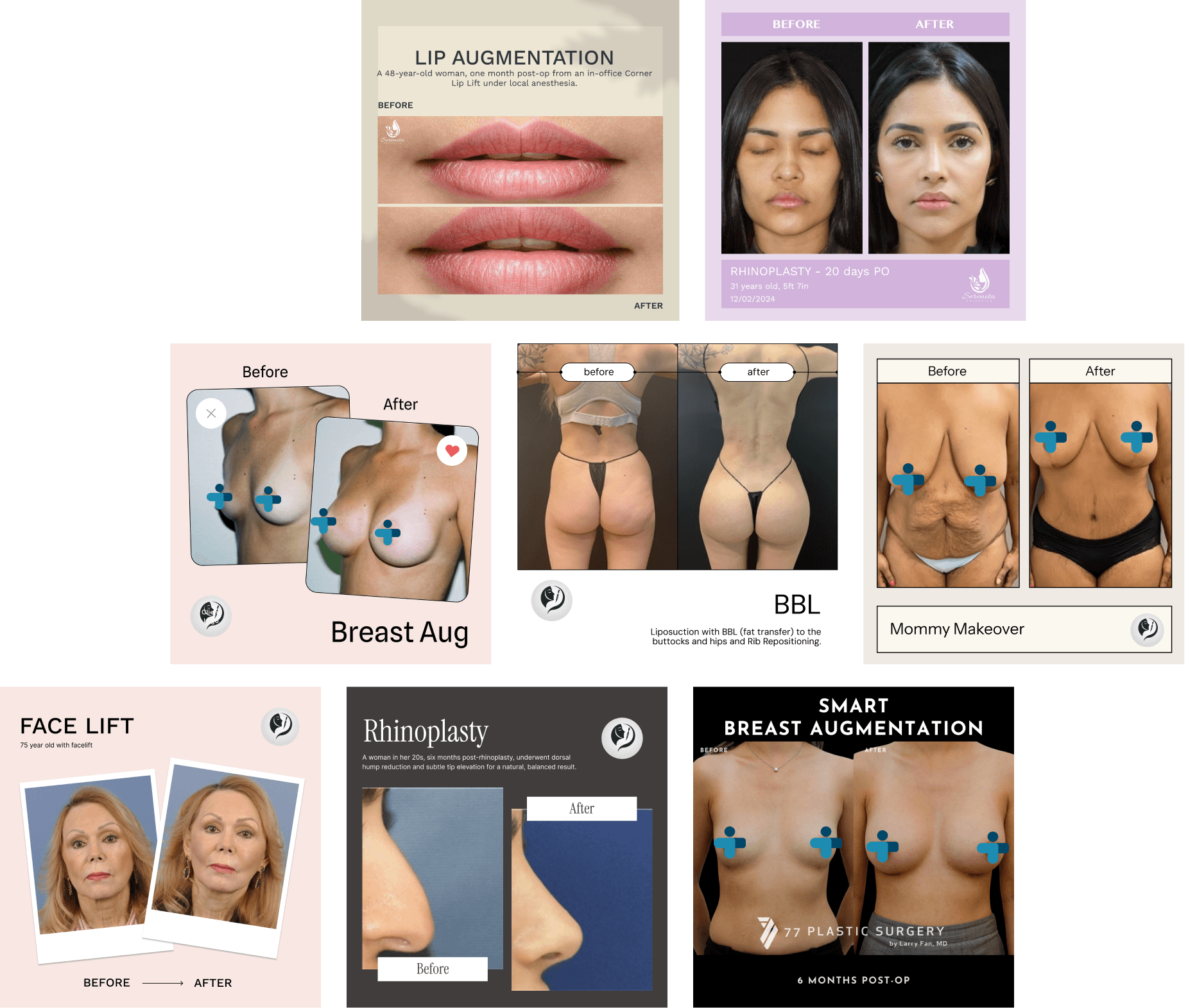 Top Aesthetics simulation demo